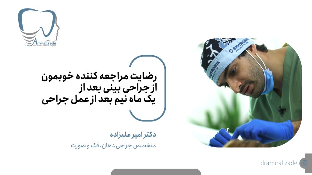 جراحی بینی دکتر امیر علیزاده