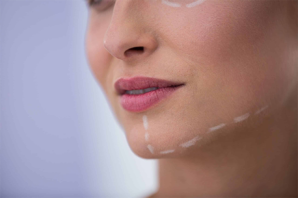 تأثیر جراحی فک بر کیفیت زندگی