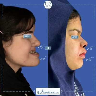 جراحی فک و صورت